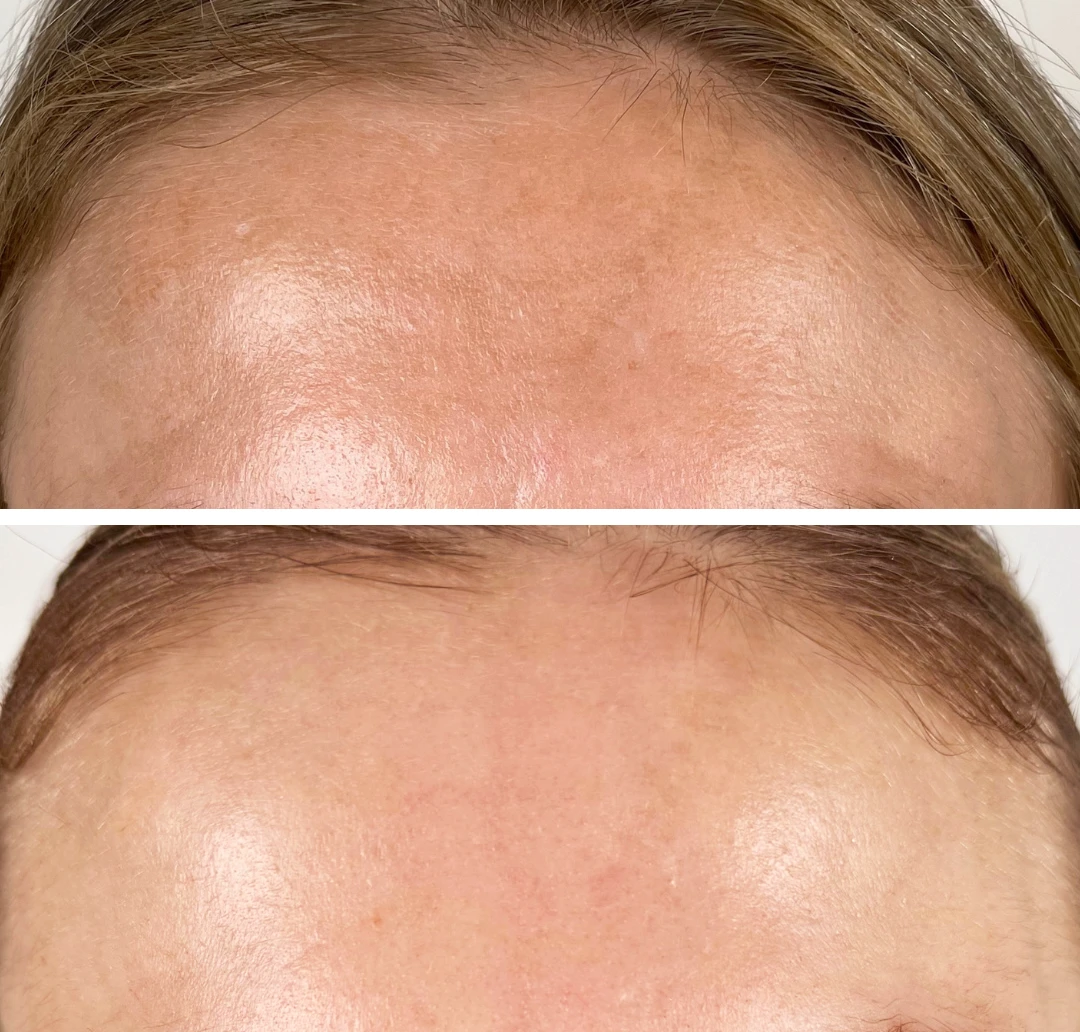 photo - Mi Bonita Cara