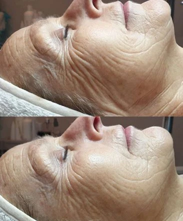 photo - Mi Bonita Cara