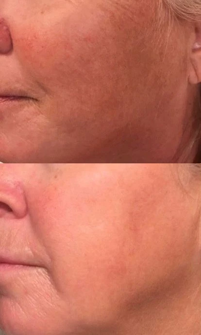 photo - Mi Bonita Cara